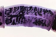 Taenia solium-detailed morphology.jpg